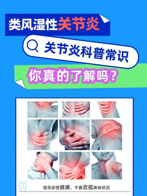 风湿类风湿关节炎危害