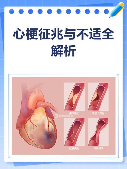 心梗脑梗的十二个症状
