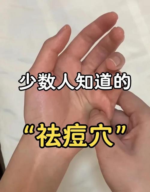 脸上长痘对应什么穴位