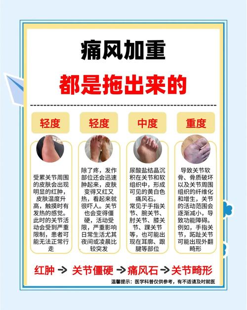 内风湿和痛风湿的区别