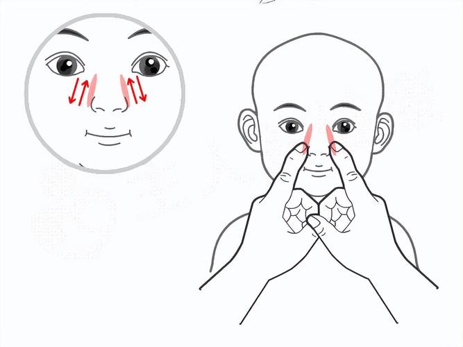 小孩鼻炎怎么按摩穴位