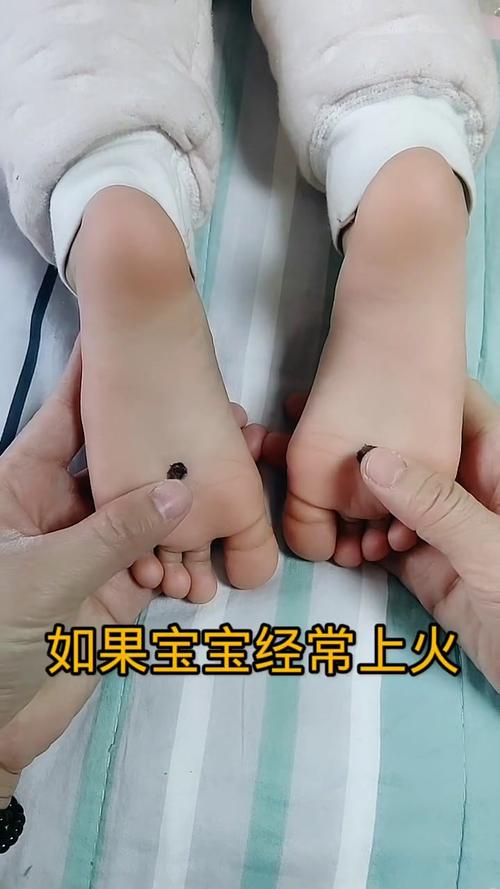 小儿上火按摩什么穴位