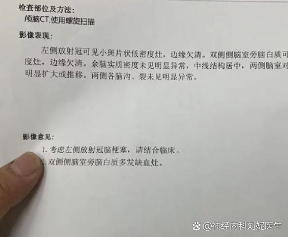 做脑彩能看出脑梗赛吗