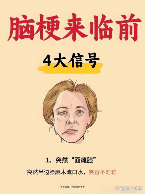 脑梗脸麻是哪个位置梗