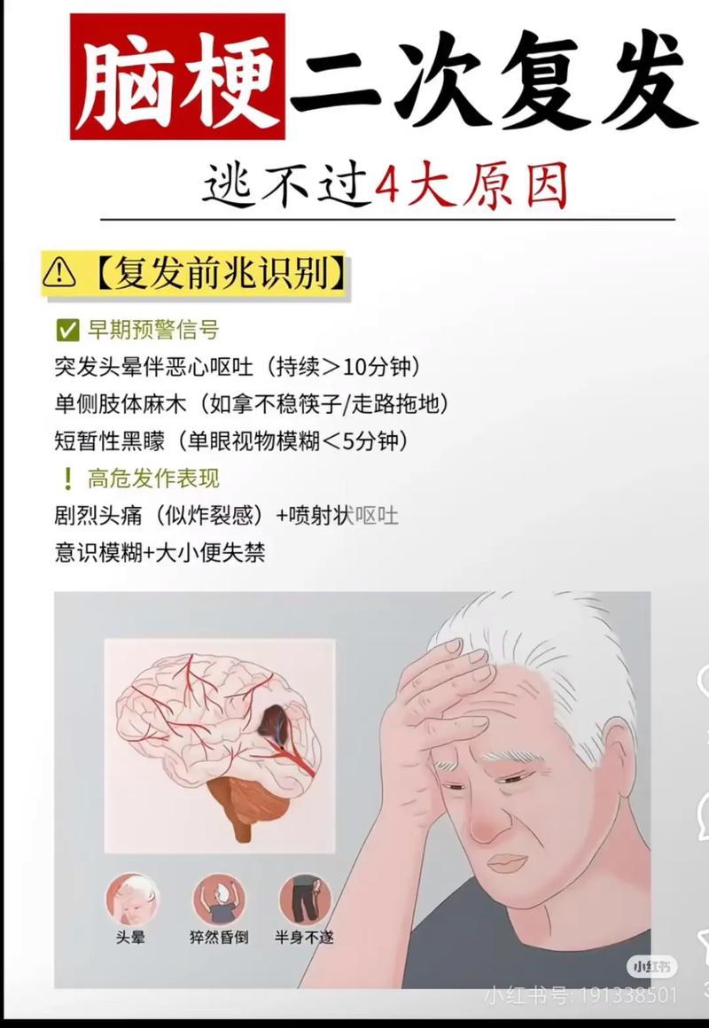 桥脑脑梗的倾向怎么办