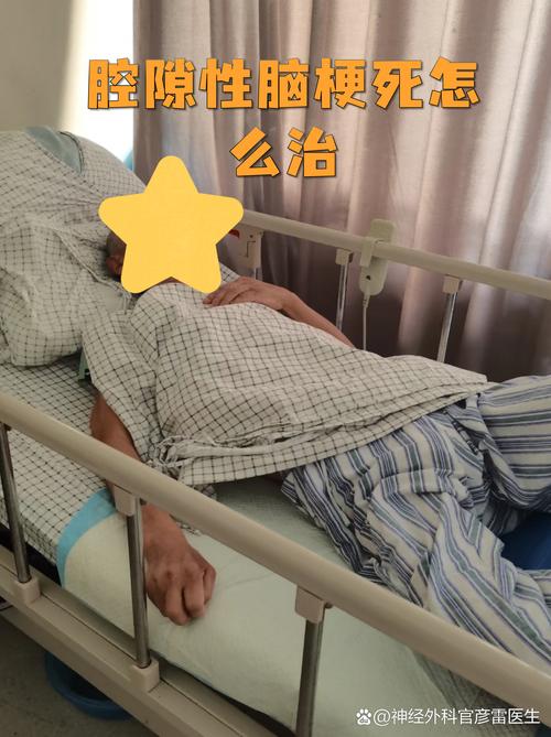 查脑梗做脑ct多少钱