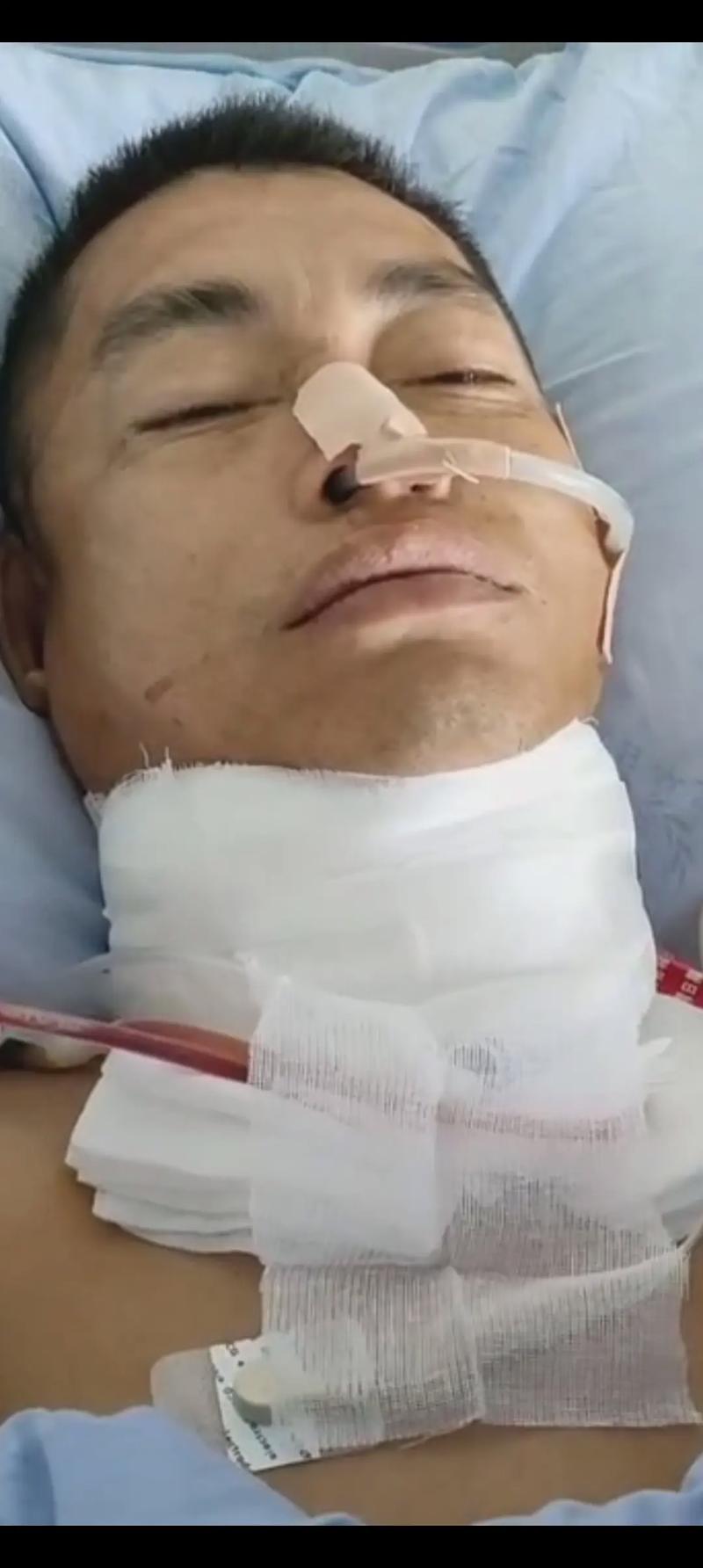 脑疝手术后继发性脑梗