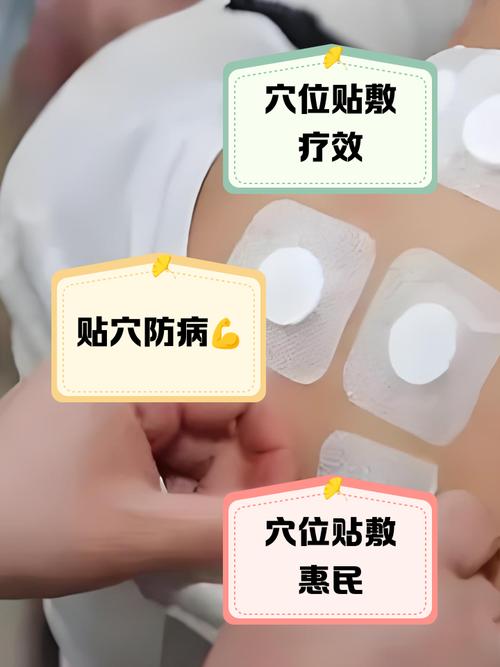 金鼎堂穴位贴敷治疗贴