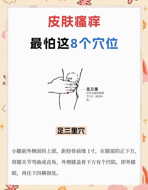 治疗神经性皮炎的穴位