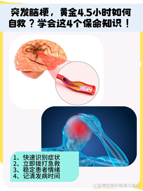 美国 脑梗 治疗方法