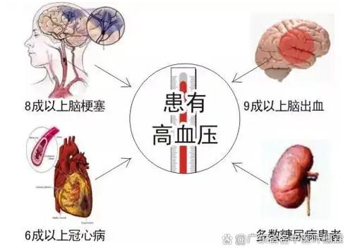 血压与心梗脑梗的关系