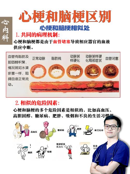 脑梗 心梗生存率多大