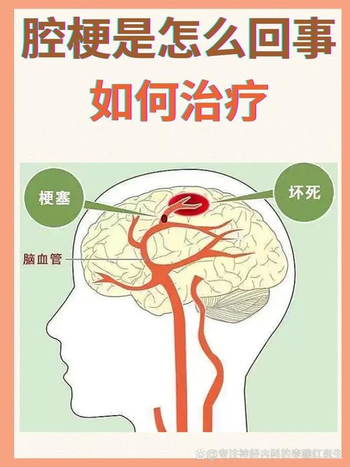 腔梗和脑梗那个难治疗