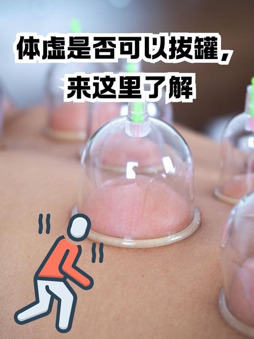 拔罐穴位图的操作方法