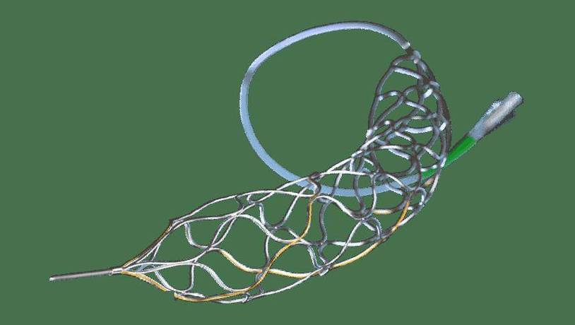 脑梗脑内血管可以安支