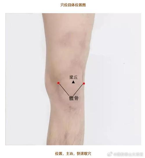 股骨头坏死的艾炙穴位