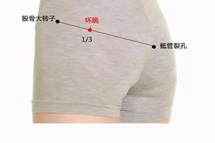 股骨头坏死的艾炙穴位