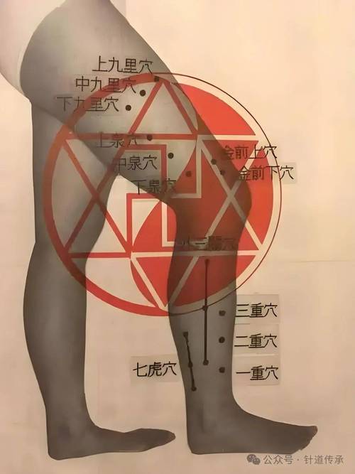 董氏七十二绝针穴位图