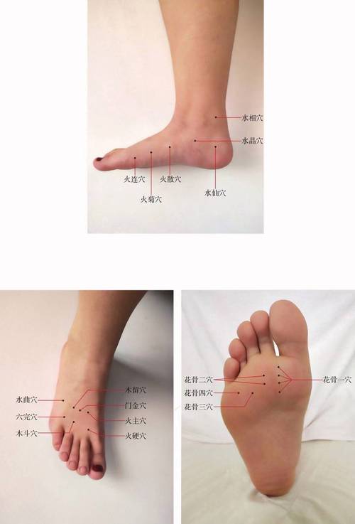 董氏七十二绝针穴位图