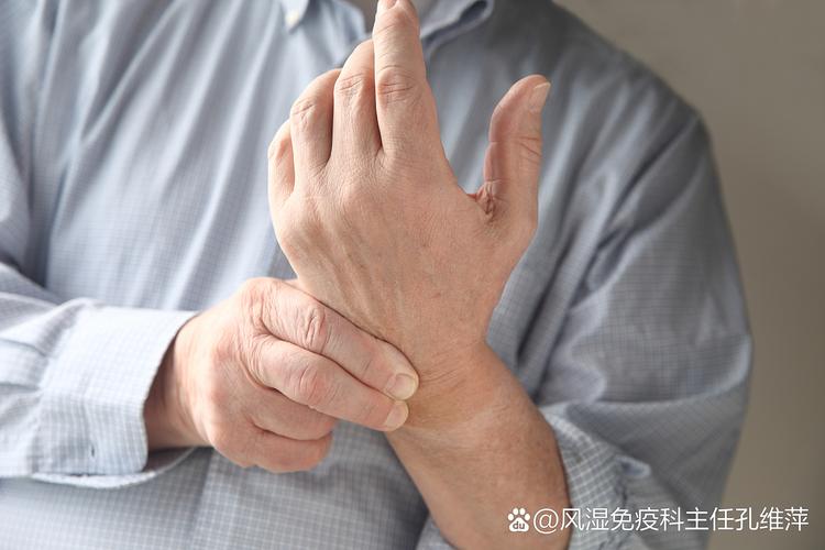 风湿类风湿 两臂发凉