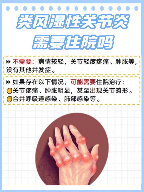 风湿类风湿免疫性疾病