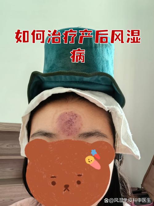 产后风湿会的类风湿吗