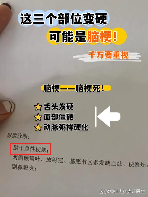 山东中医心梗脑梗前兆