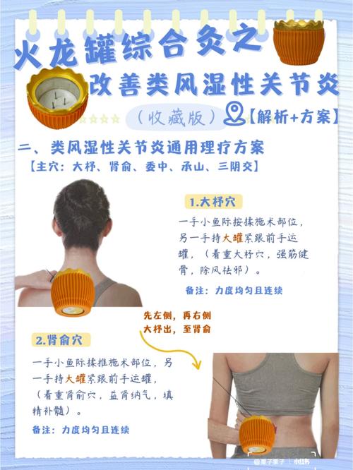 风湿类风湿患者怎么治