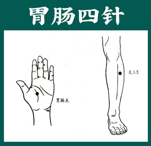 慢性肠胃炎按哪些穴位