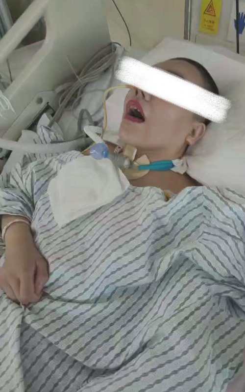 脑梗病人 落泪 昏迷