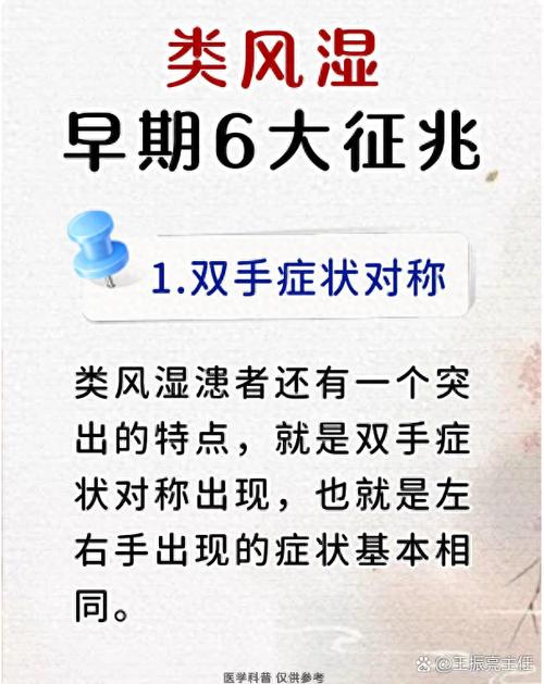 风湿可发展成类风湿吗