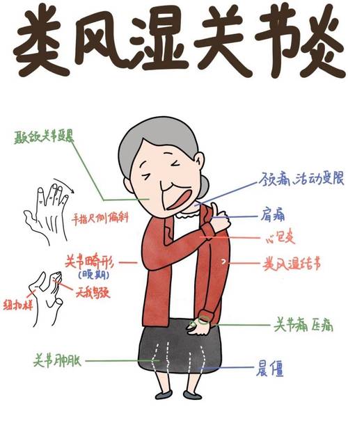 肩痛是风湿还是类风湿