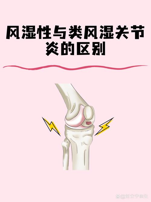 类风湿和风湿什么区别