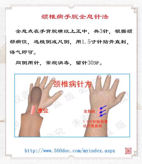 颈椎病可以穴位注射吗