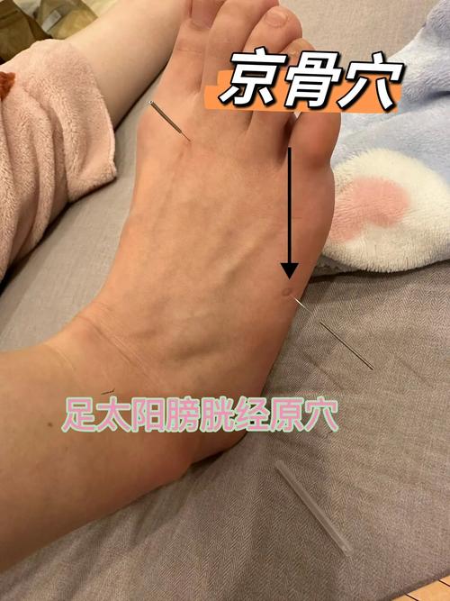 京骨穴位痛是怎么回事