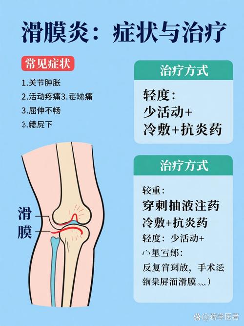 风湿性滑膜炎 抗风湿