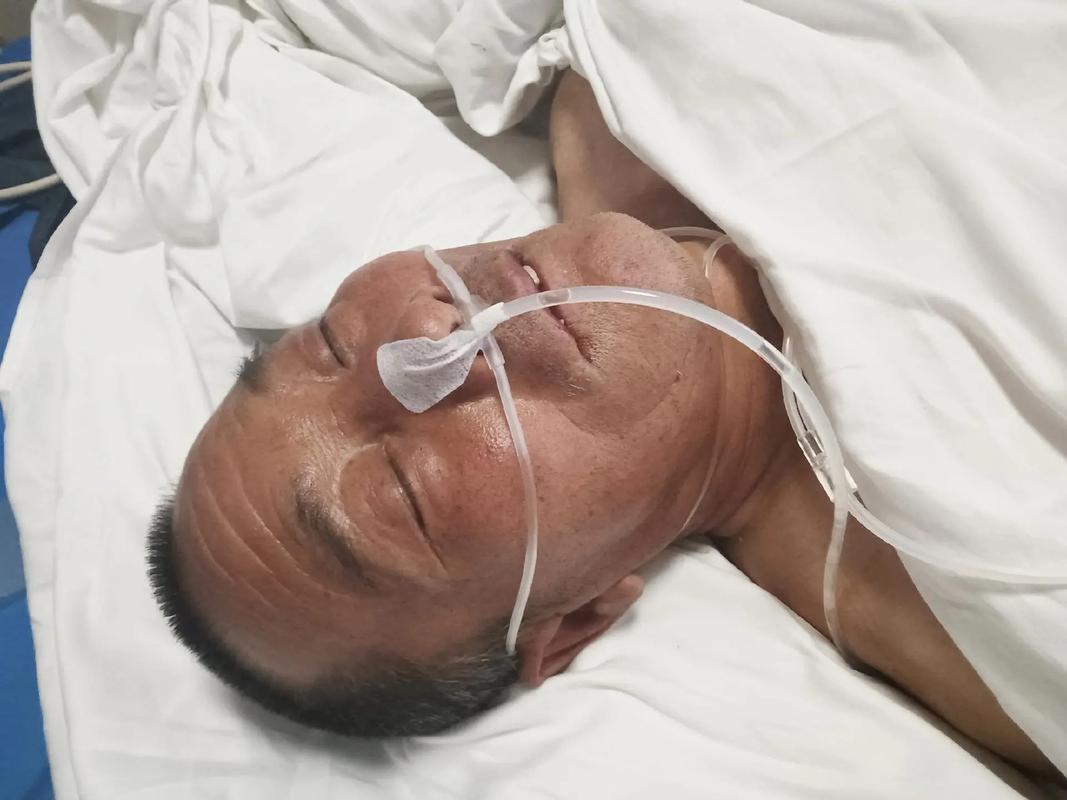 脑梗 面积不大 昏迷