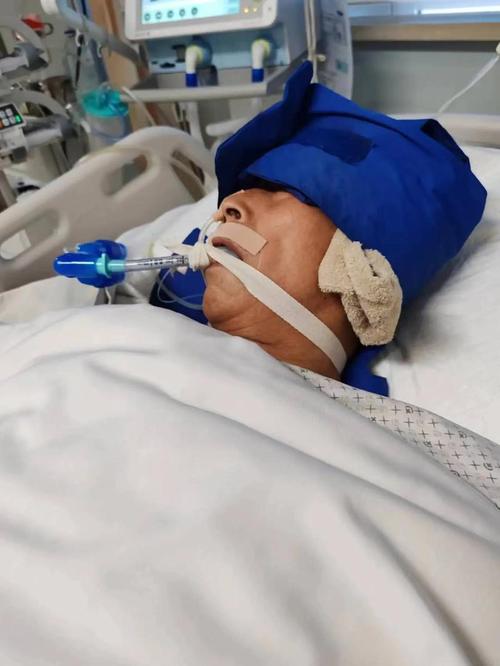 脑梗 面积不大 昏迷