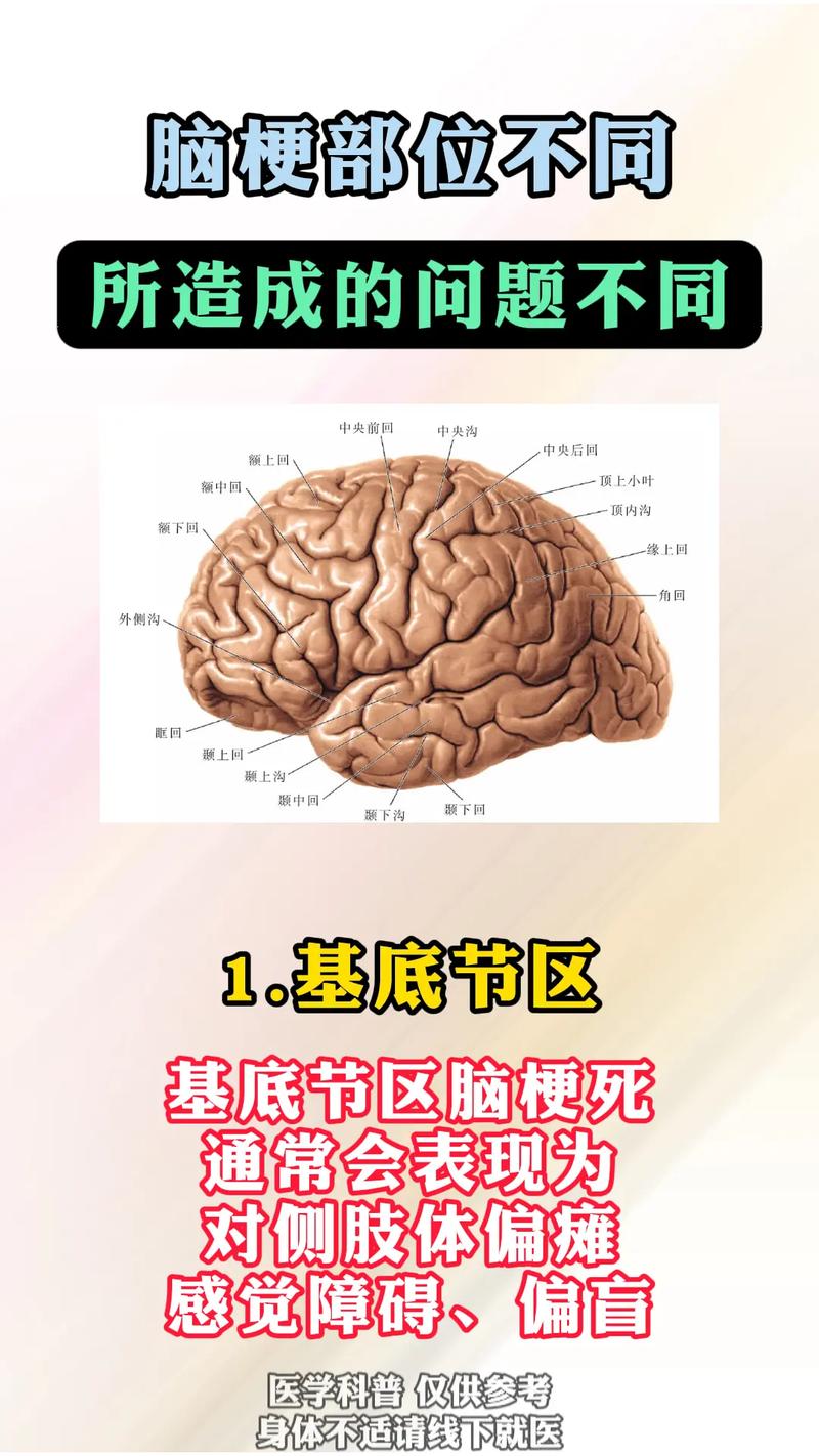 脑梗过的部位还会梗吗