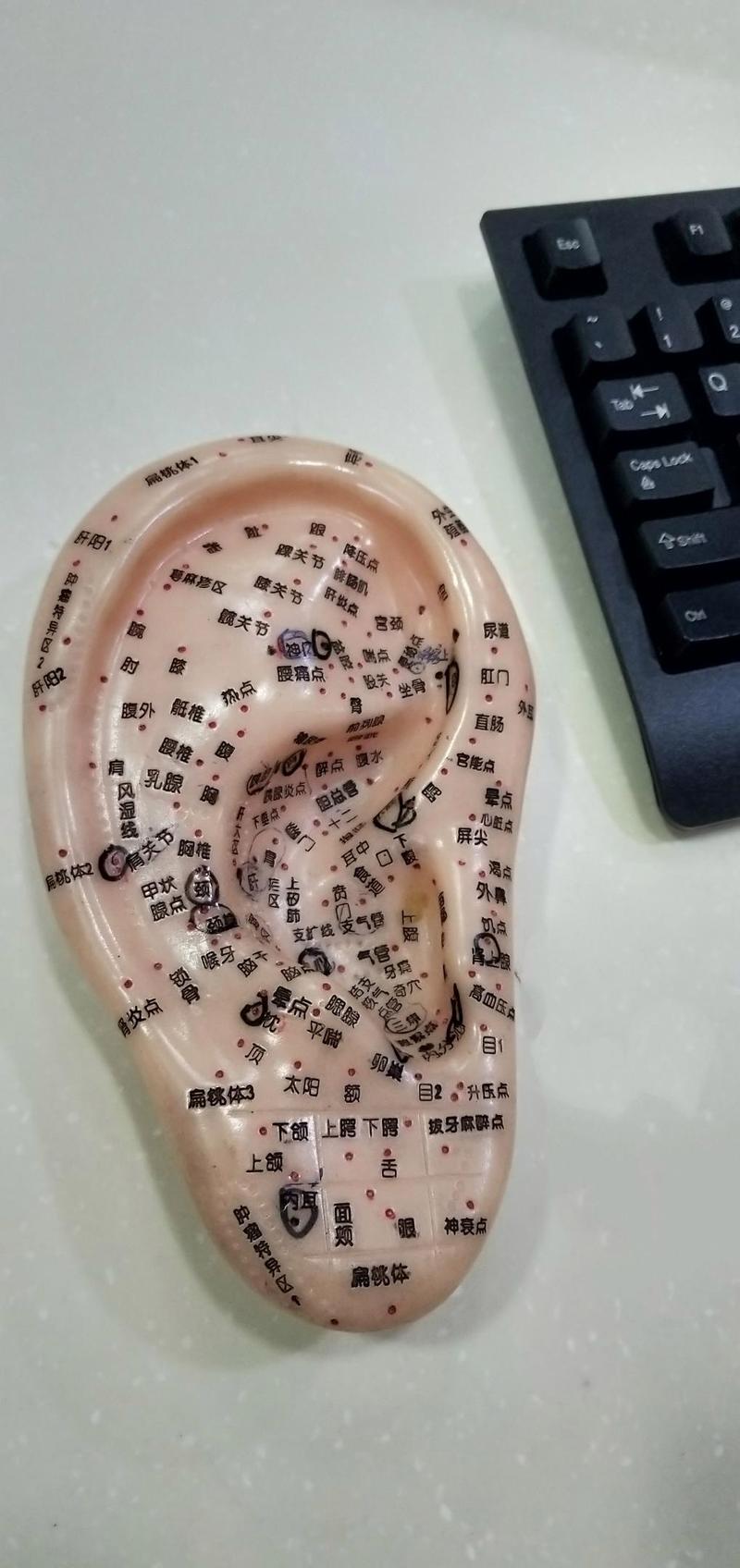 针灸治疗中耳炎的穴位