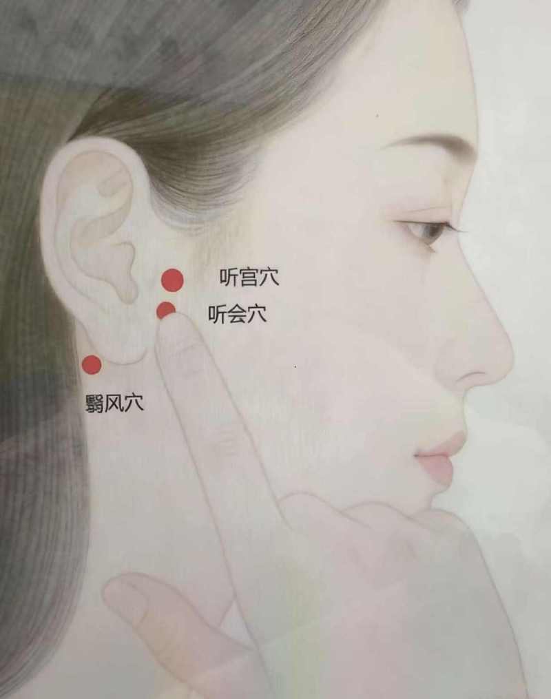 针灸治疗中耳炎的穴位