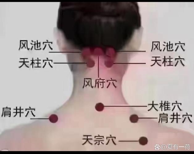 风池穴和天柱穴位置图