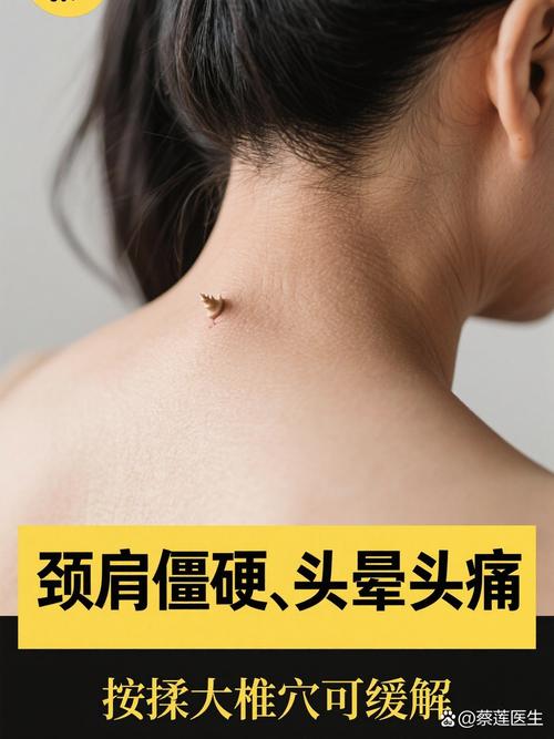 颈椎病头晕按什么穴位