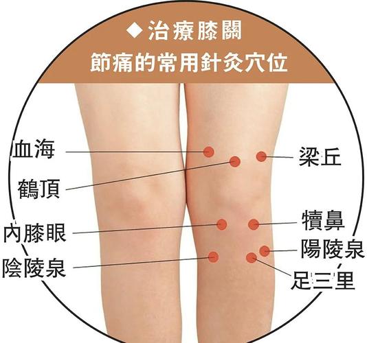 膝关节疼痛按什么穴位