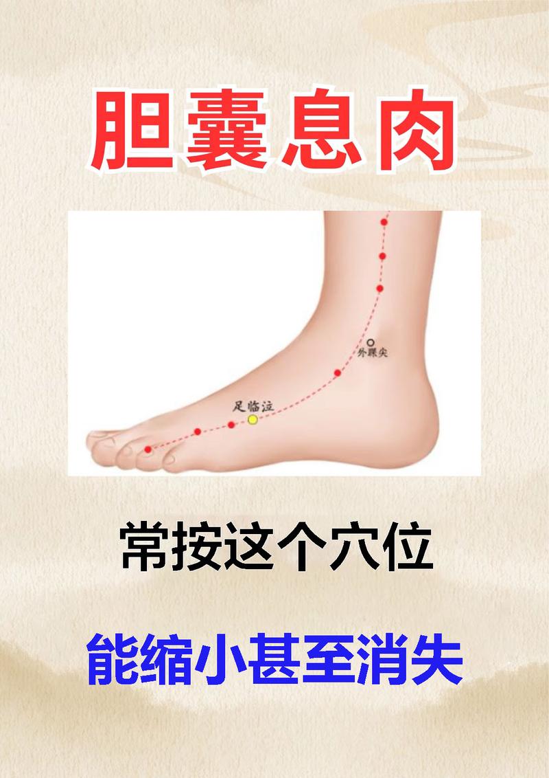 胆囊息肉艾灸什么穴位