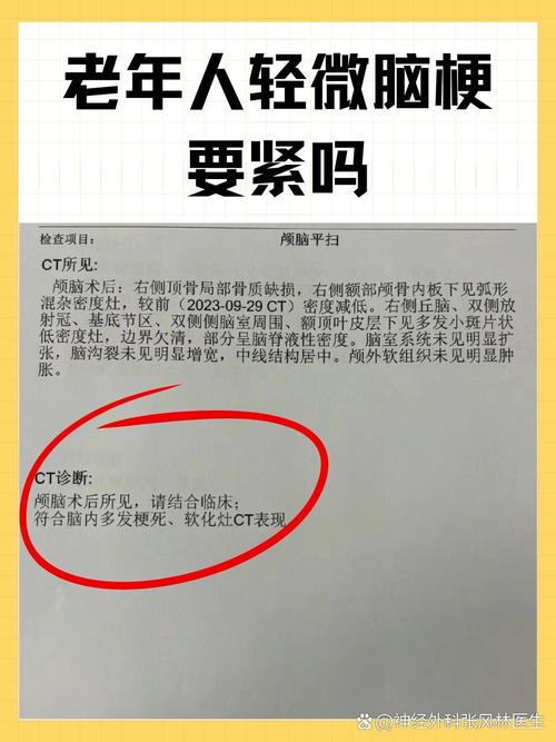 体检能查出脑梗心梗吗