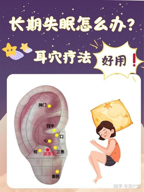 耳朵上治疗失眠的穴位