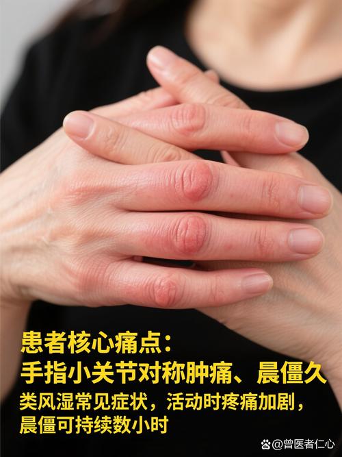 风湿和类风湿是头晕吗