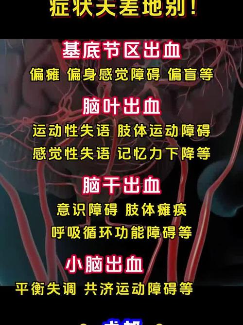 心梗脑梗脑出血的区别