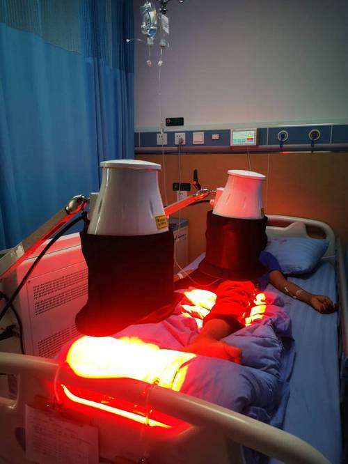 风湿类风湿针灸理疗仪